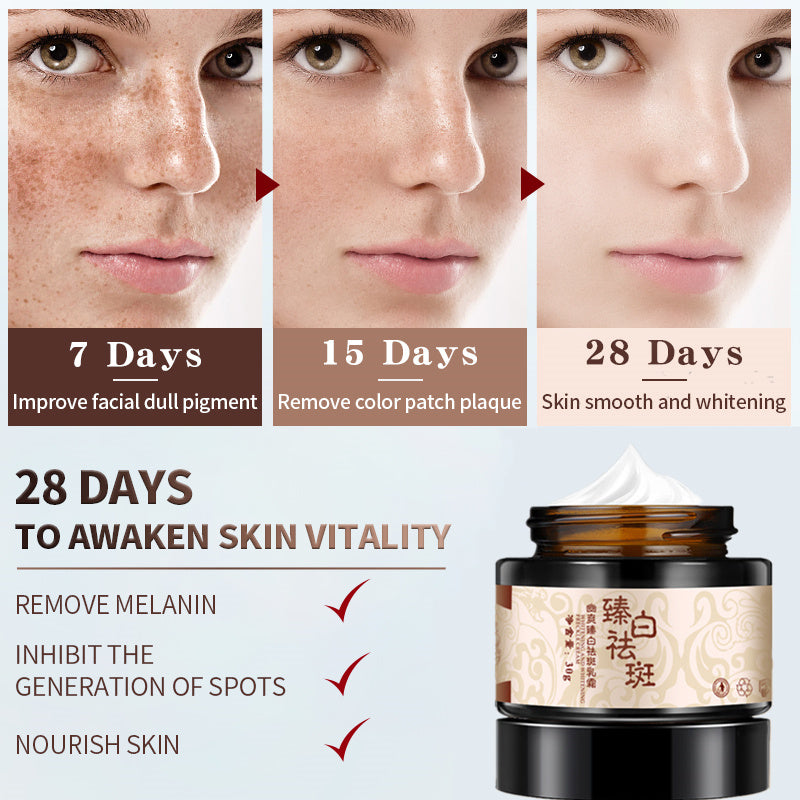 Freckle Removing Cream lighten spots and whiten skin