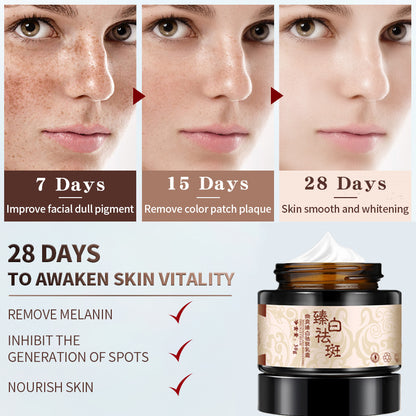 Freckle Removing Cream lighten spots and whiten skin