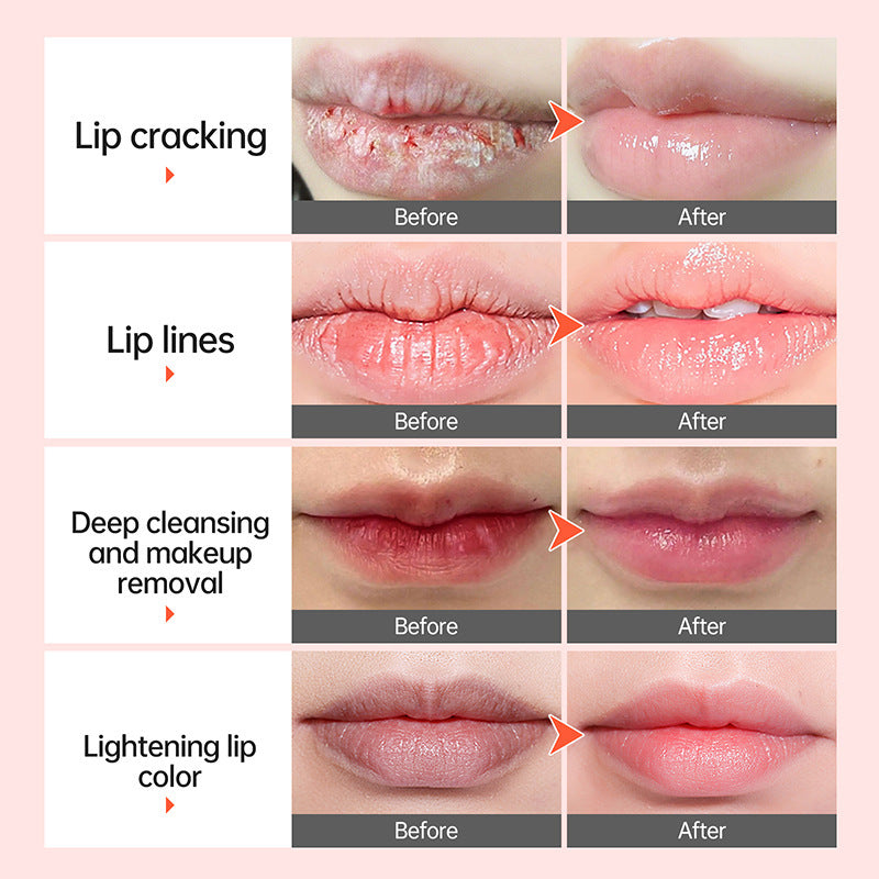 4 in1 Anti-chapping, Exfoliating, Brightening, and Cleansing Lip Balm