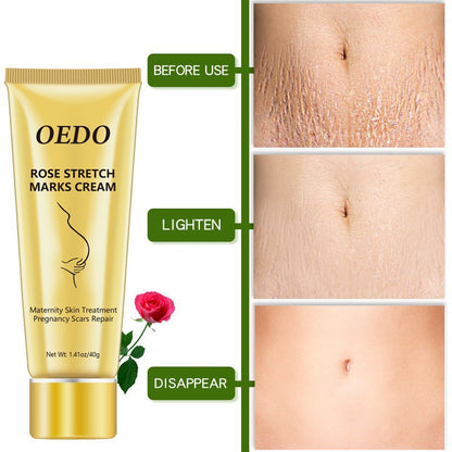 Rose Stretch Mark Removal Cream